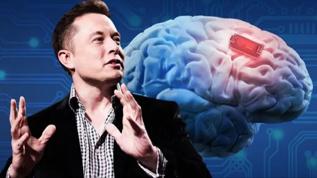 Elon Musk'ın beyin çipi projesinin insan deneyleri için onay aldığı bildirildi