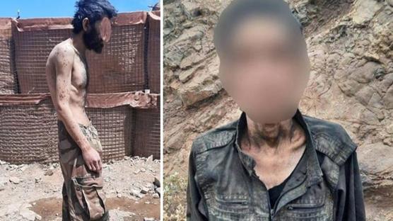 PKK'lı teröristler sefalet içinde: Açlıktan bağırsakları delinmiş