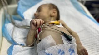 Gazze'de Leyla bebek yetersiz beslenme nedeniyle yaşam mücadelesi veriyor