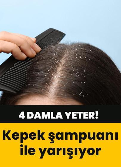 Kepek şampuanlarıyla yarışıyor! 4 damla yetiyor...