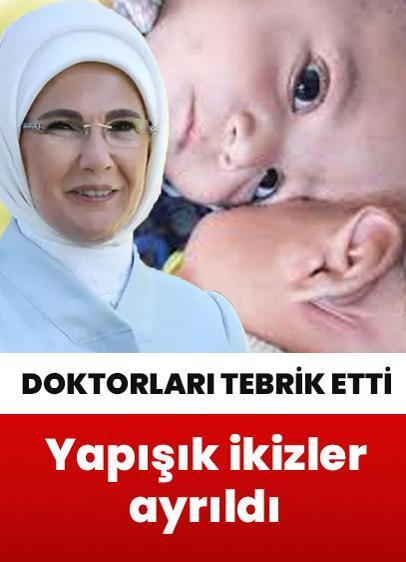 Emine Erdoğan Pakistanlı yapışık ikizleri ayıran doktorları tebrik etti