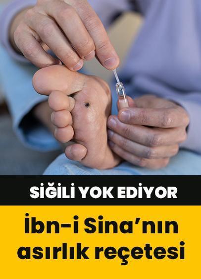 O bitki siğili yok ediyor! Ovalamak yetiyor! Pürüzsüz cildin sırrı İbn-i Sina reçetesi