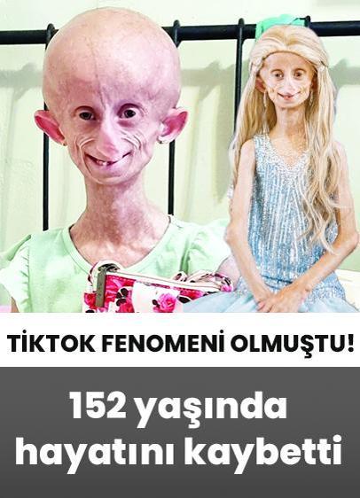 TikTok fenomeni ‘152' yaşında hayatını kaybetti!