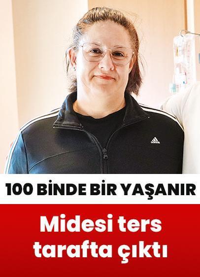 Midesi ters tarafta çıktı