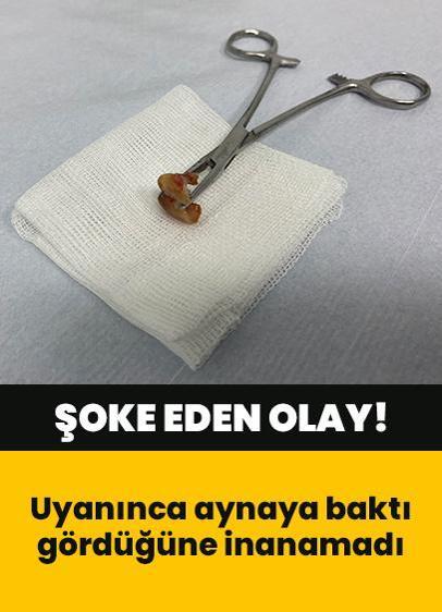 Şoke eden olay: Uyanınca aynaya baktı gördüğüne inanamadı! Ne olduğunu anlamak için hastaneye koştu