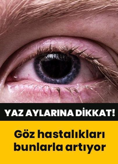 Göz hastalıkları yazın havuz ve deniz aktiviteleriyle artıyor
