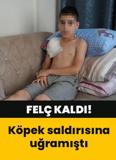 Köpek saldırısına uğrayan 11 yaşındaki çocuğun kolu felç kaldı