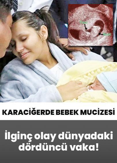 İlginç olay dünyadaki 4. vaka olarak kayıtlara geçti! Karaciğerde büyüyen bebek mucizesi