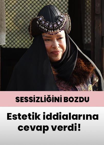 Selma Güneri'den estetik yaptırdığı iddialarına cevap!