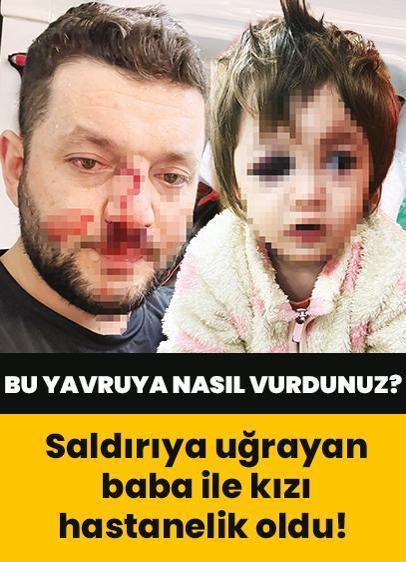 Komşularının saldırısına uğrayan baba ile 14 aylık kızı hastanelik oldu! Bu yavruya nasıl vurdunuz?
