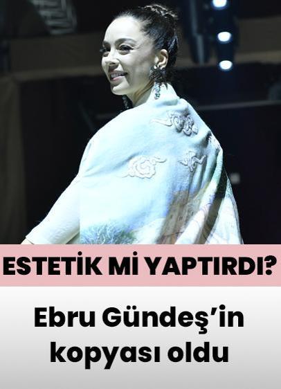 Azra Akın estetik mi yaptırdı? Ebru Gündeş'in kopyası oldu