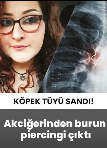 Akciğerinden burun piercingi çıktı