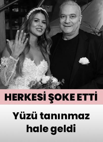 Mehmet Ali Erbil ile boşanmıştı... Gülseren Ceylan'ın yüzü tanınmaz hale geldi
