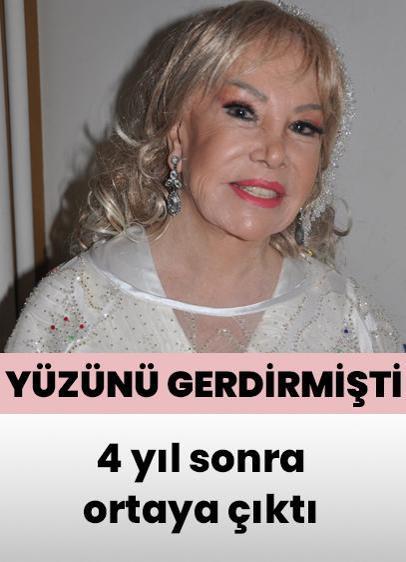 Bedia Akartürk 4 yıl sonra ortaya çıktı! Yüzünü gerdirmişti…