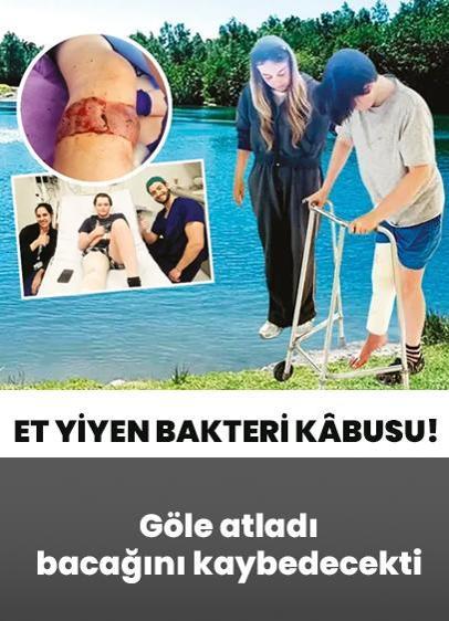 Et yiyen bakteri kâbusu! Göle atladı bacağını kaybedecekti