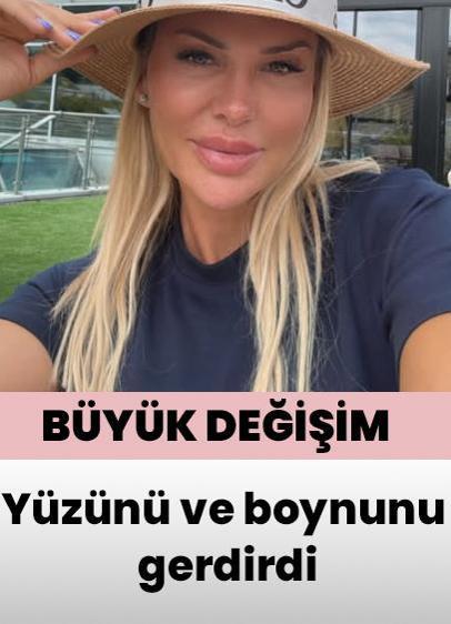 Nagihan Karadere yüzünü ve boynunu gerdirdi! Büyük değişim